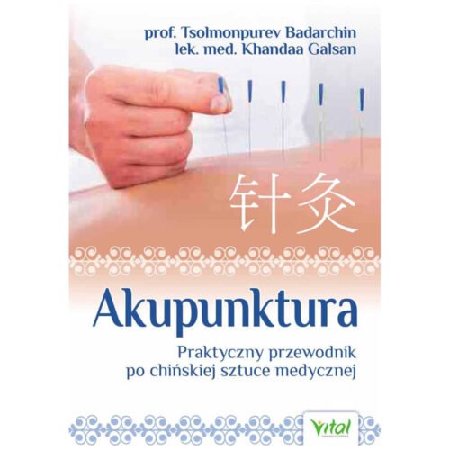 Akupunktura